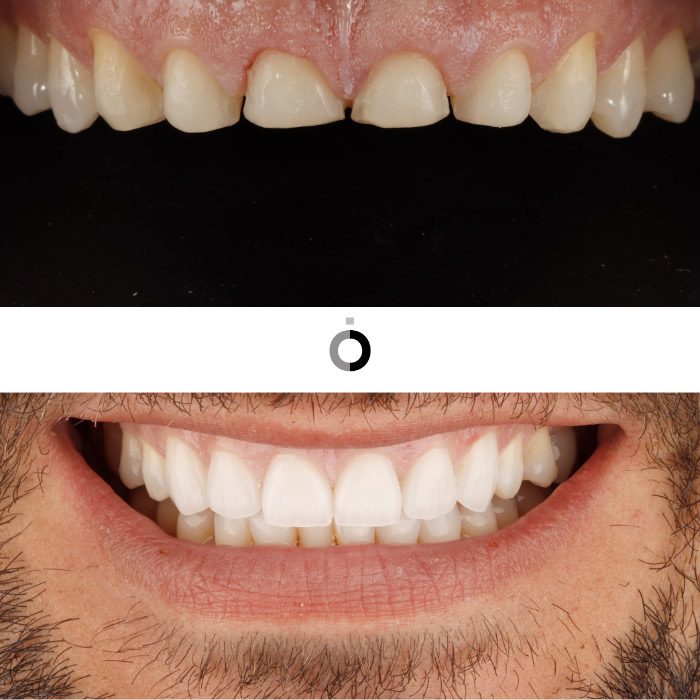 odontologia estetica clinica dental Anatomia bilbao